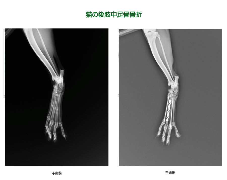 後肢中足骨骨折