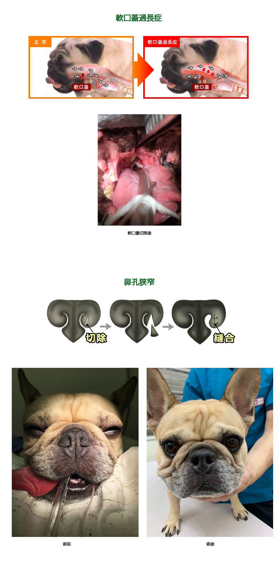 短頭腫症候群